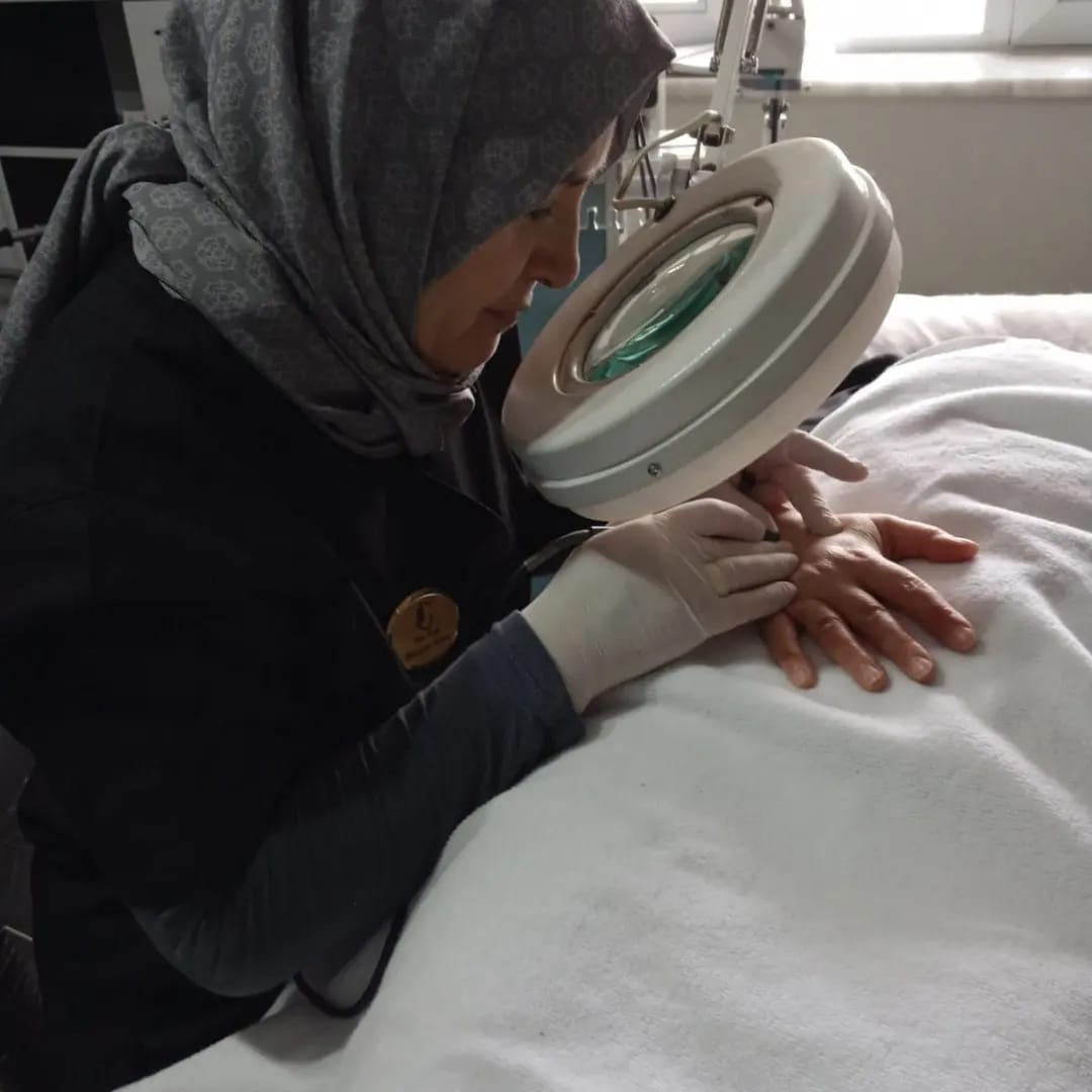 Günışığı Güzellik Salonu Galeri - İğneli Epilasyon